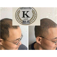 石家庄专业纹发_纹发