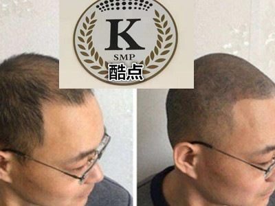 石家庄专业纹发_纹发