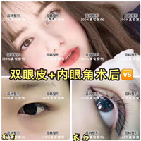 上海哪里做下巴整形好