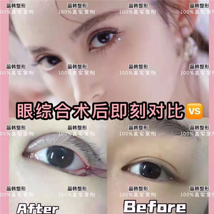 上海哪里做下巴整形好