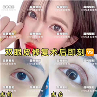 上海哪里做下巴整形好