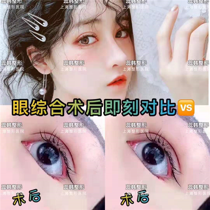 上海做鼻子整形哪家好
