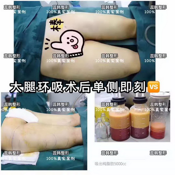 蕊韩医美