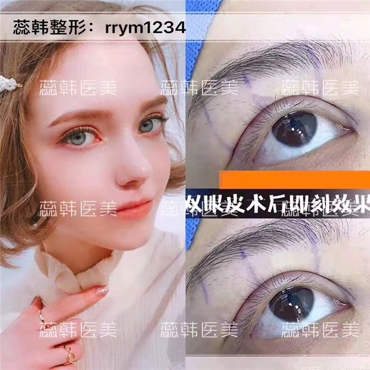 上海做整形比较好的医院
