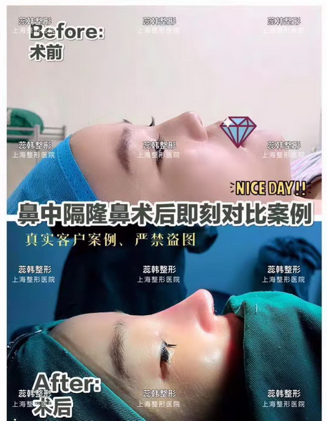 上海做整形比较好的医院