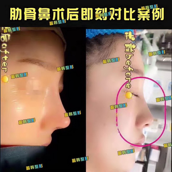 上海做鼻子整形哪家好
