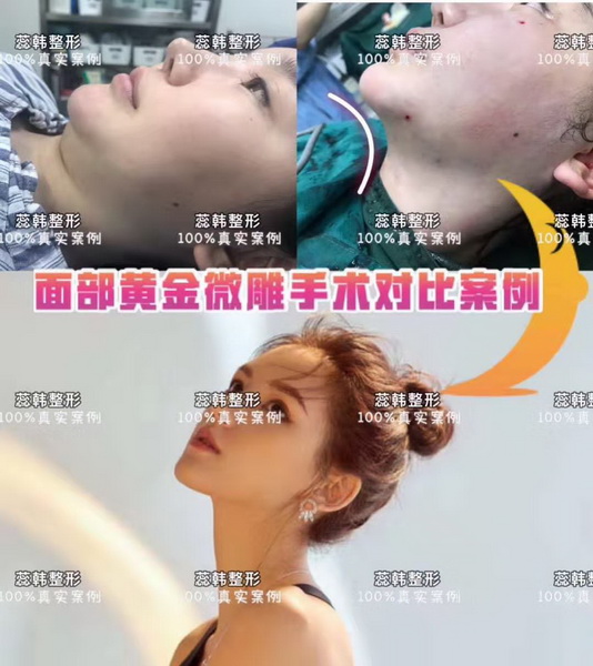上海鼻整形哪里好