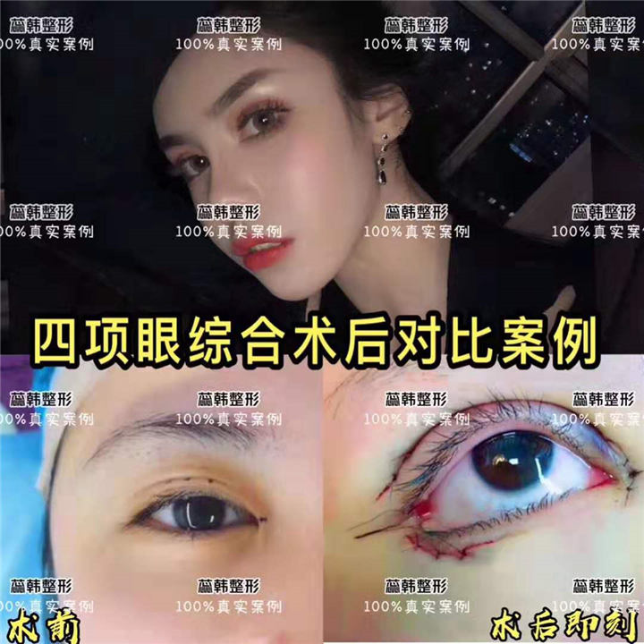 上海做整形哪个医院好