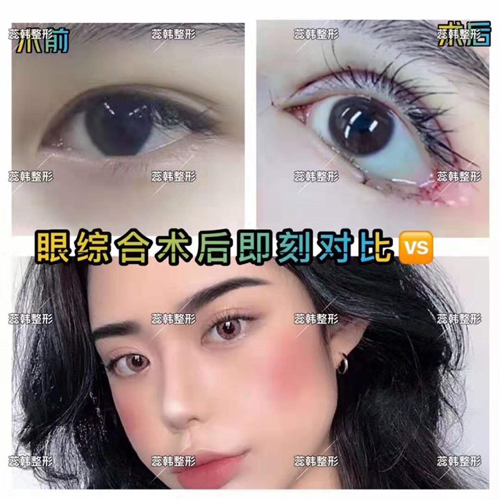 上海哪家做整形比较好