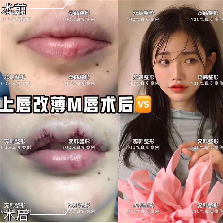 上海网红整形