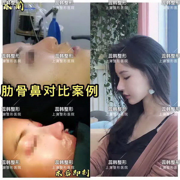 上海做整形比较好的医院