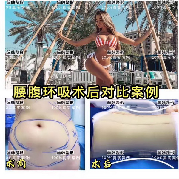 上海蕊韩医美整形