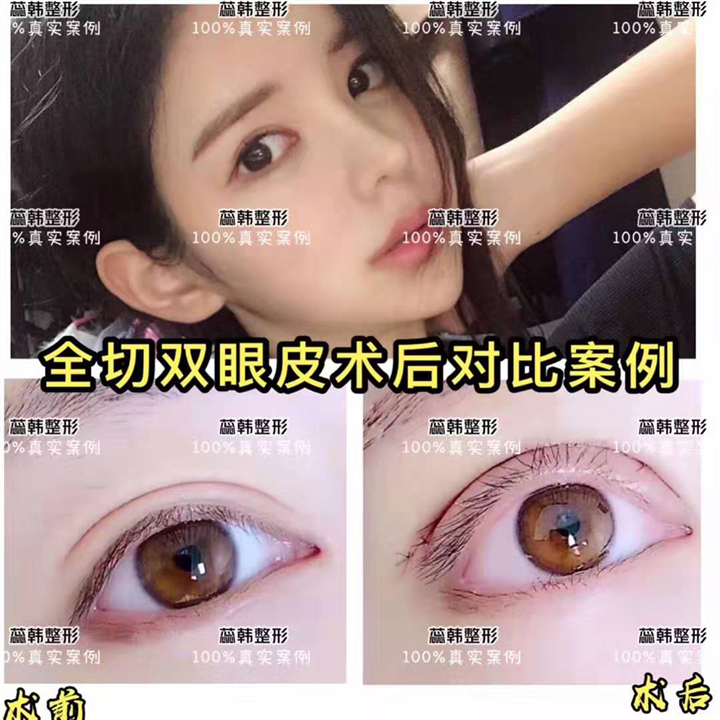 上海做整形哪个医院好