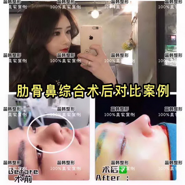 上海哪家做整形比较好