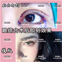 上海哪里做下巴整形好