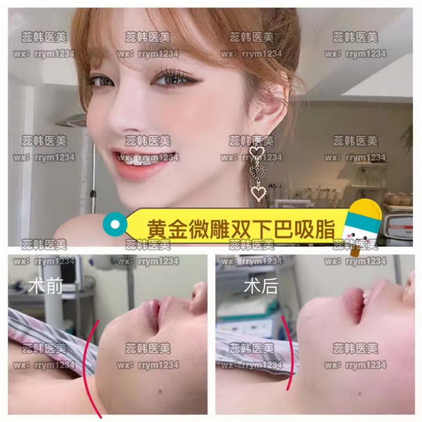 上海整鼻子哪个医院好