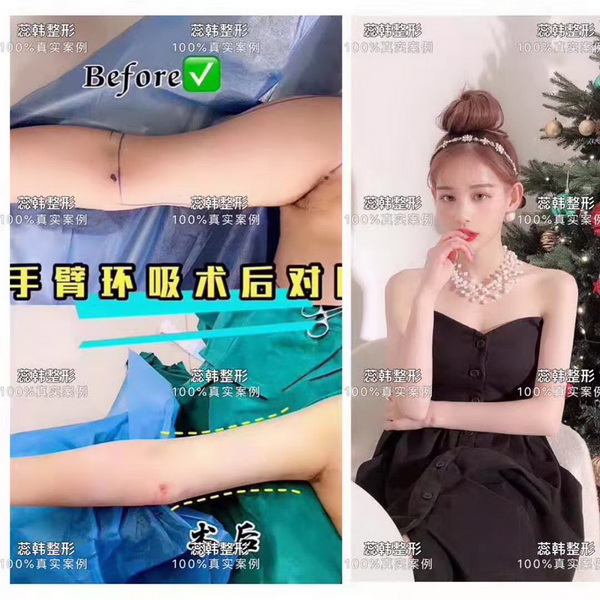 上海做整形哪个医院好