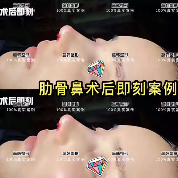 上海哪家做整形比较好