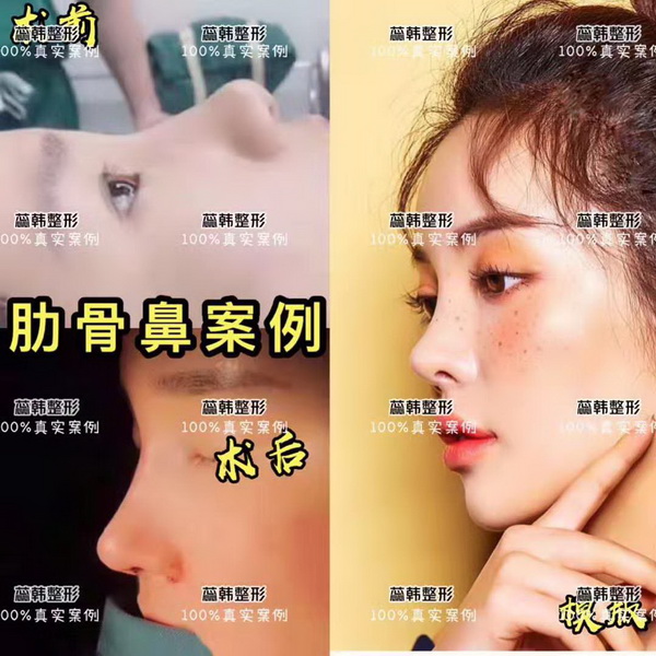 上海哪家做整形比较好