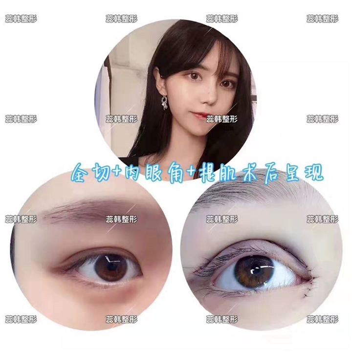上海做整形比较好的医院