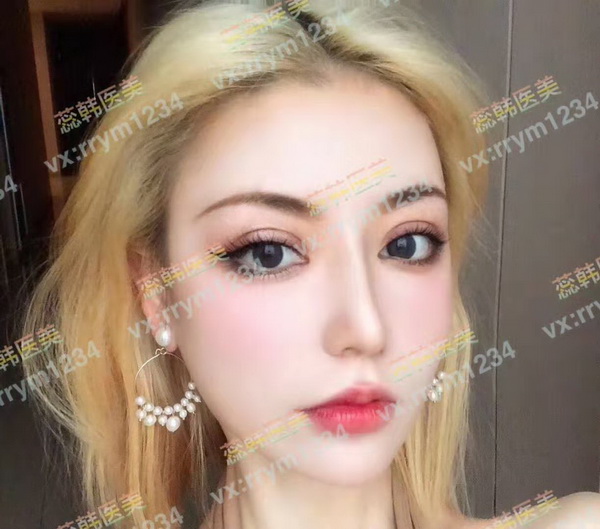 上海有哪些鼻整形好的医生