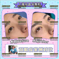 马昌华整形