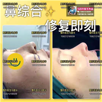 上海鼻综合修复