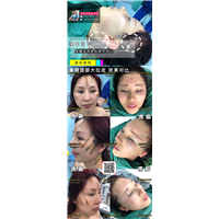 上海拉皮手术医生马昌华 
