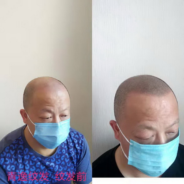 深圳专业纹发 