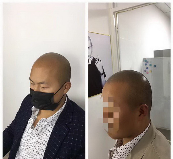 江门smp纹发 