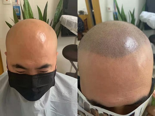 成都纹发 