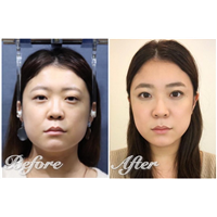 上海日式小颜整骨