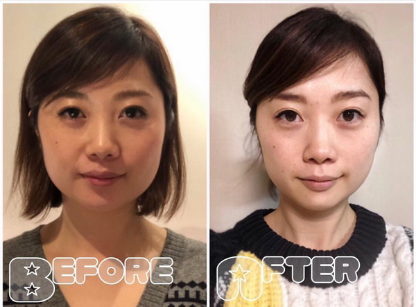 上海日式小颜整骨培训