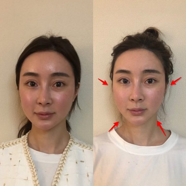 上海日式小颜整骨