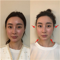 上海日式小颜整骨