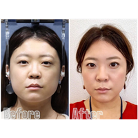 上海日式小颜整骨