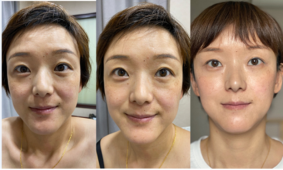 皮肤问题及困扰时间