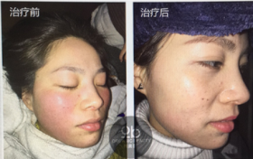 皮肤问题及困扰时间