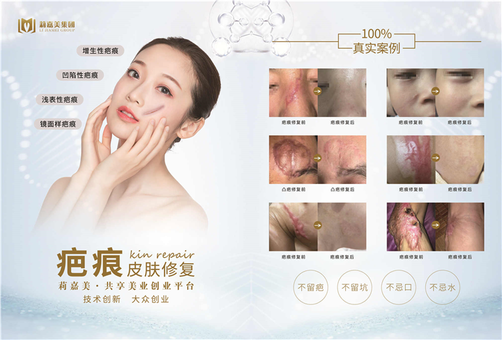 莉伽美集团祛疤痕皮肤修复