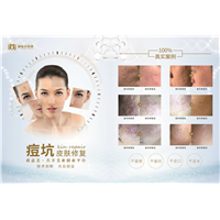 莉伽美集团祛痘坑皮肤修复