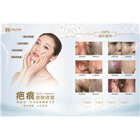 莉伽美集团祛疤痕皮肤修复