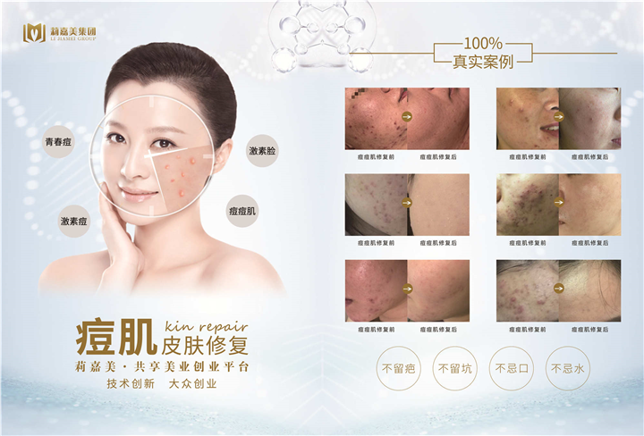 痘肌皮肤修复