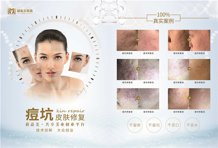 莉伽美集团祛痘坑皮肤修复
