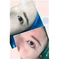 北京眼部整形专家 