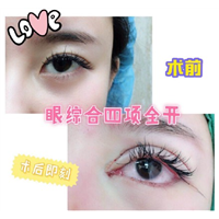 北京眼综合整形专家 