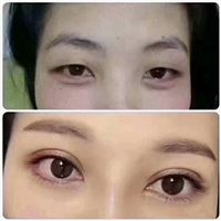 深圳眼综合修复专家
