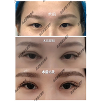 深圳眼综合修复专家