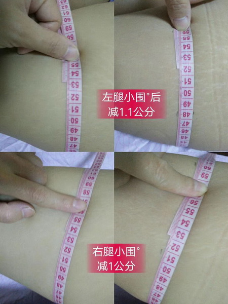 杭州皮肤管理加盟