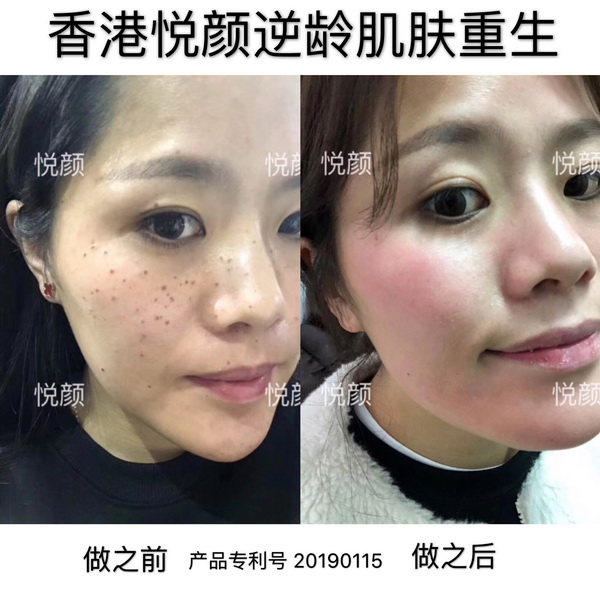 杭州皮肤管理培训