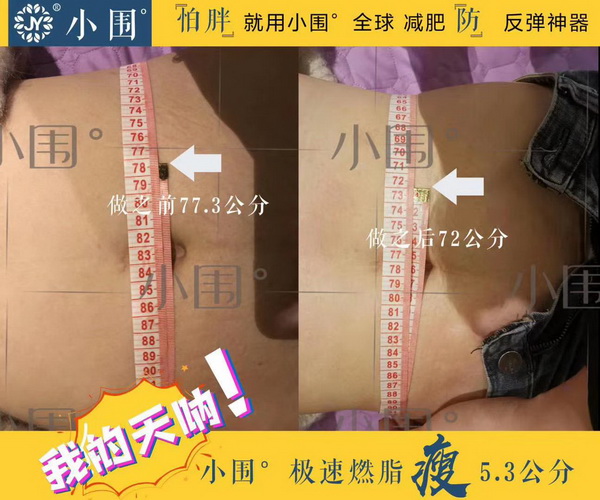 杭州韩式皮肤管理培训